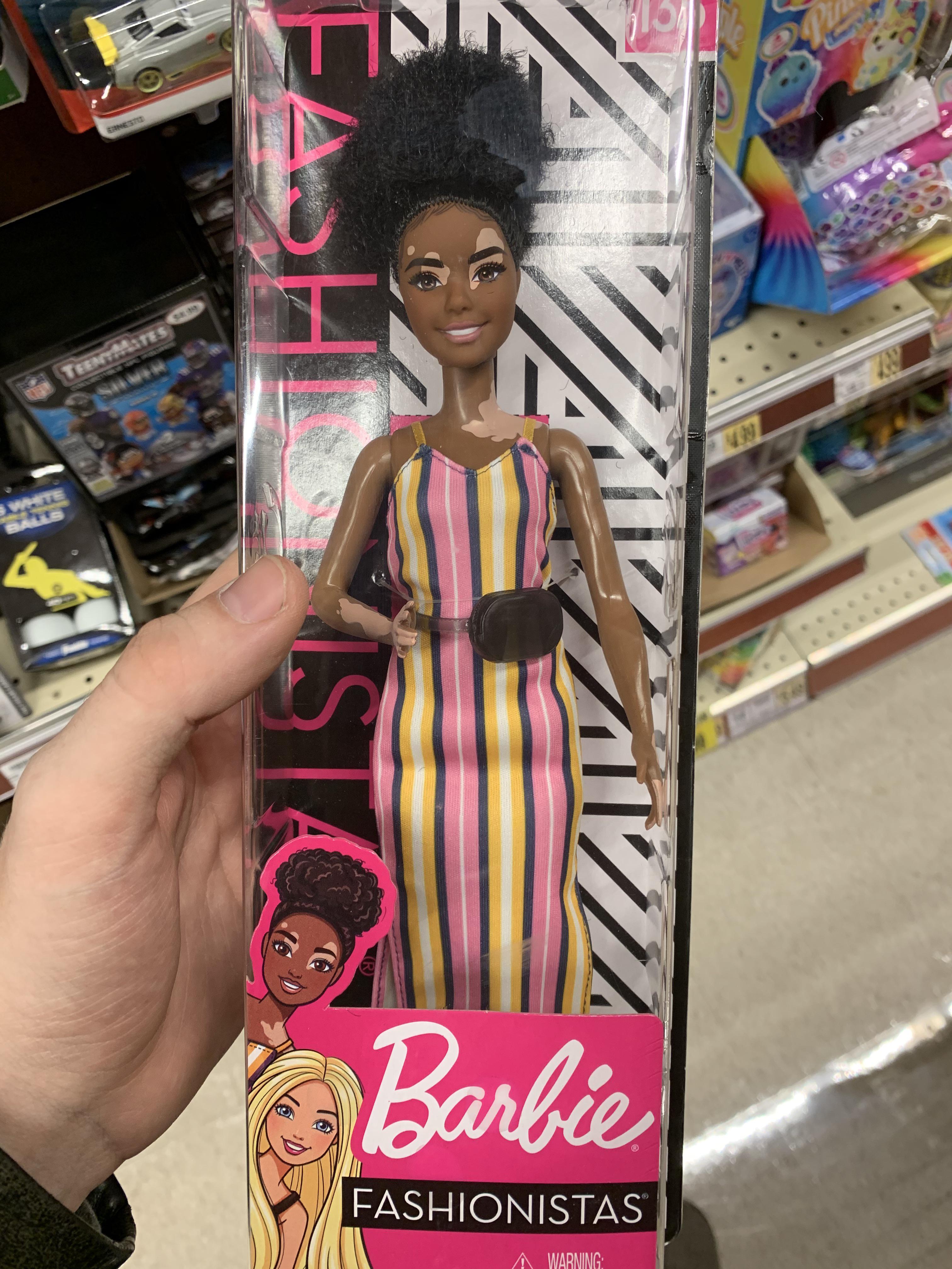 Vitiligo Barbie