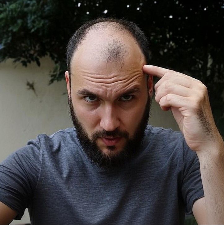 Embrace What You Have