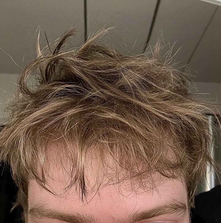 Never Skip Conditioning