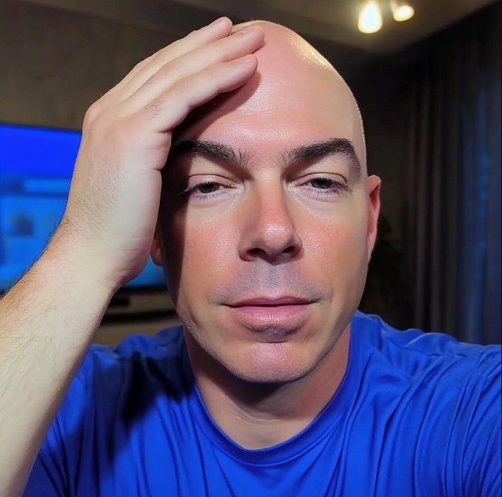 Sunscreen Your Scalp