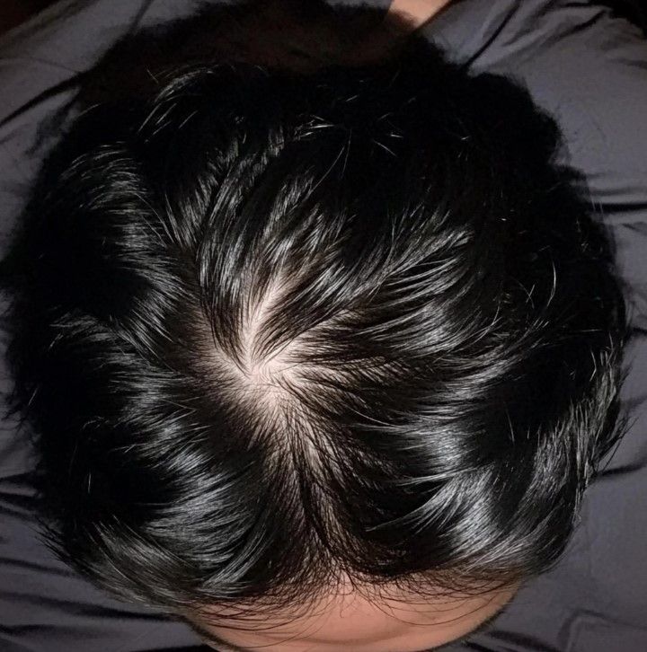 How to Style the Cowlick