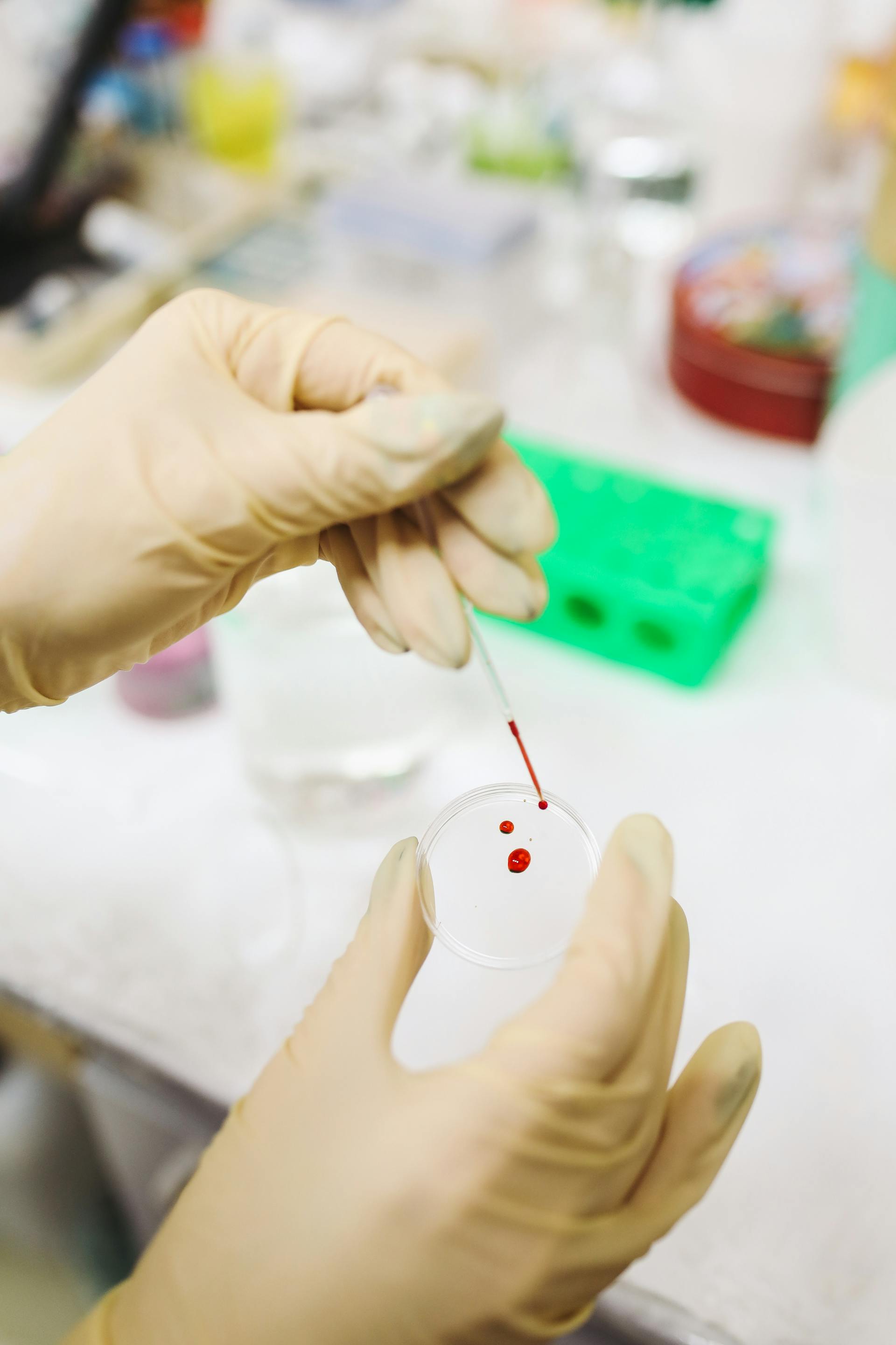 Random Blood Test Caught Hidden Diabetes